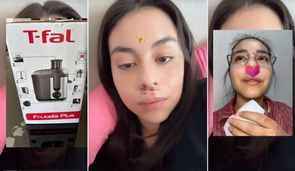 Accidente con extractor de jugos deja a joven herida: advertencia viral en TikTok