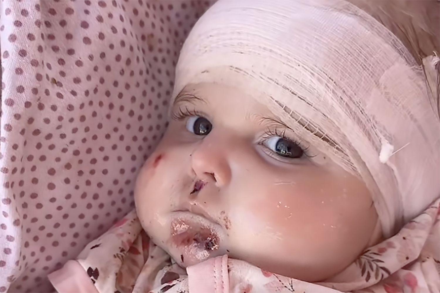 Muerte de bebé conmueve redes: la lucha contra enfermedad rara