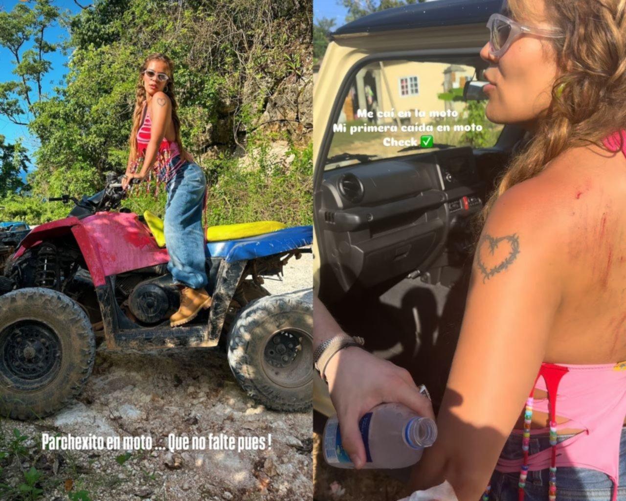 Karol G sufre accidente en moto durante vacaciones en Jamaica: las impactantes fotos