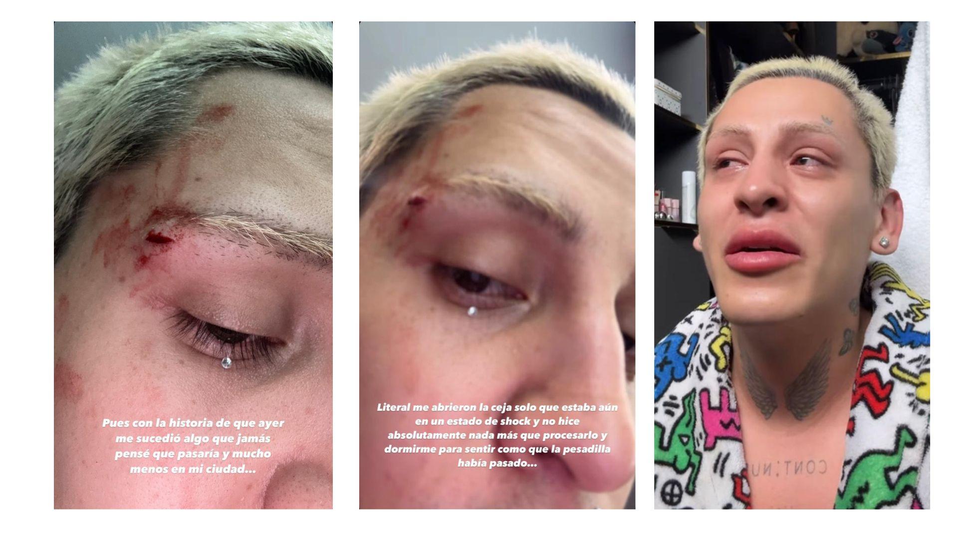 Ataque homofóbico a Kunno: La agresión que revela una verdad incómoda