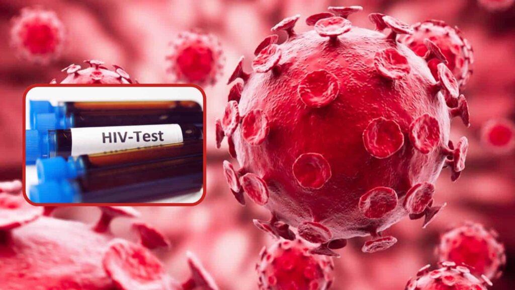 VIH: La verdad detrás del falso brote global que circula en redes