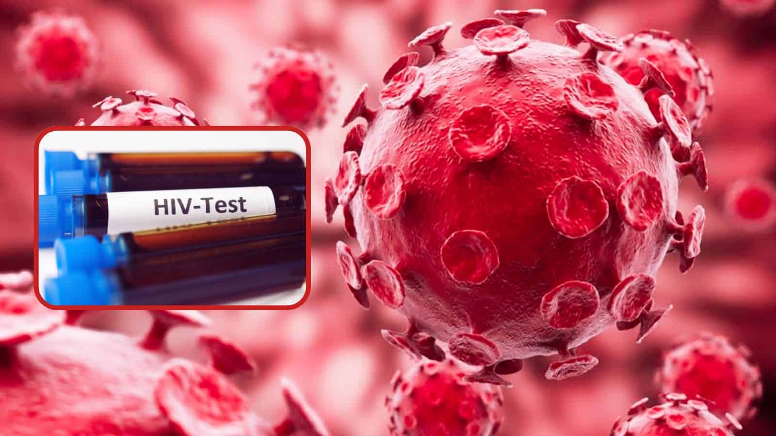 VIH: La verdad detrás del falso brote global que circula en redes