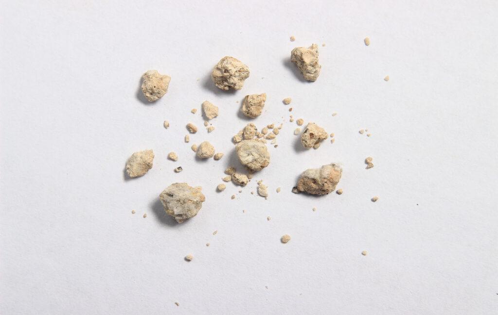 Cálculos renales: cómo el té de perejil puede ayudarte a eliminarlos