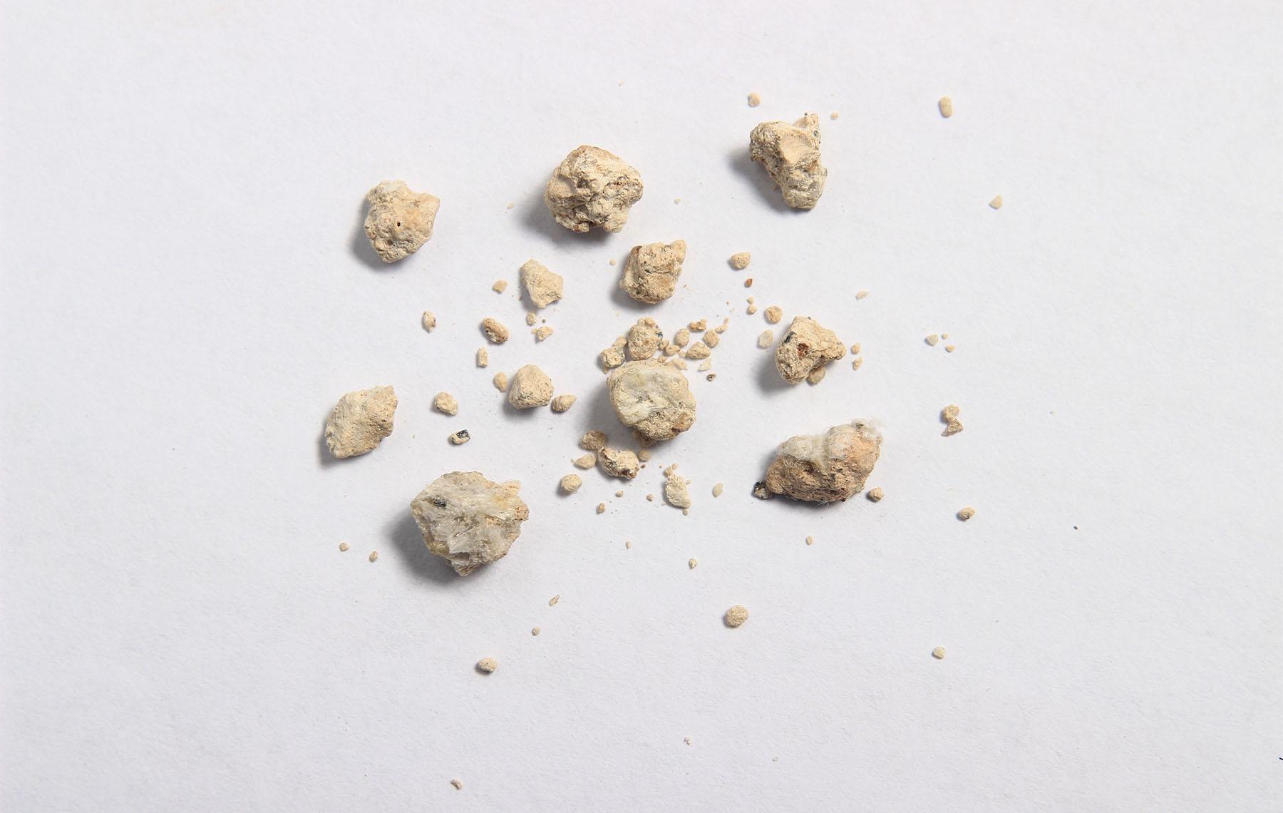 Cálculos renales: cómo el té de perejil puede ayudarte a eliminarlos