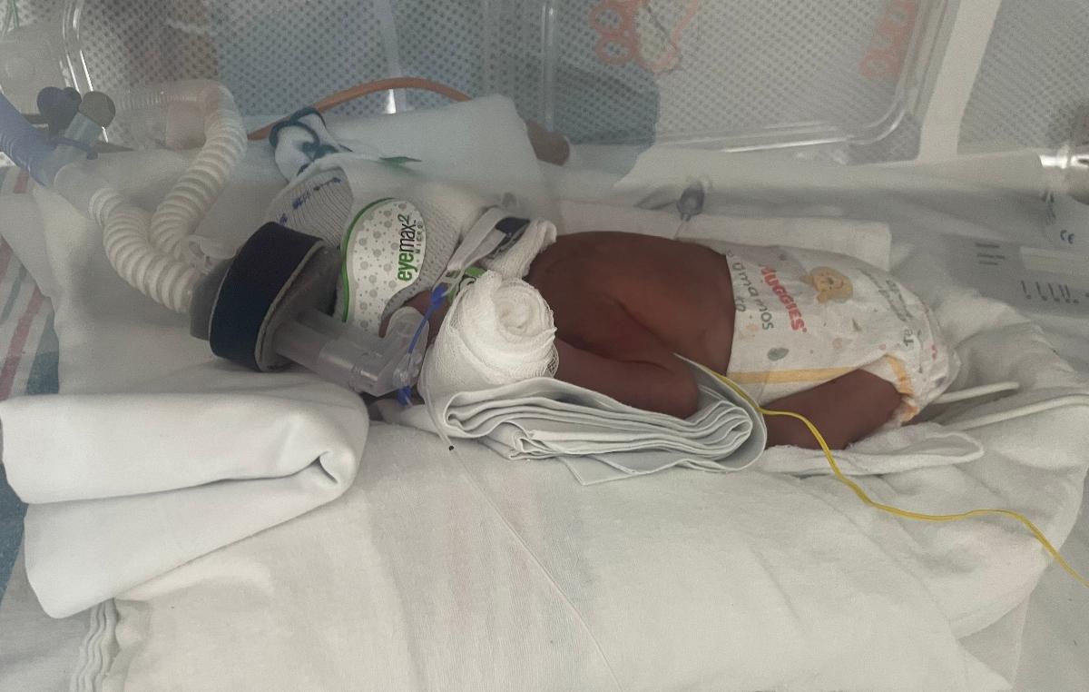 Gastón, el bebé prematuro que lucha por vivir: necesita tu ayuda urgente