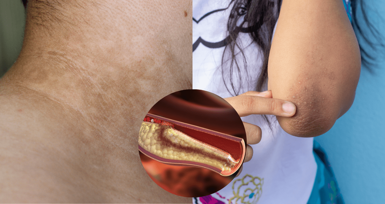 Resistencia a la insulina: las 4 bebidas que disparan tu riesgo