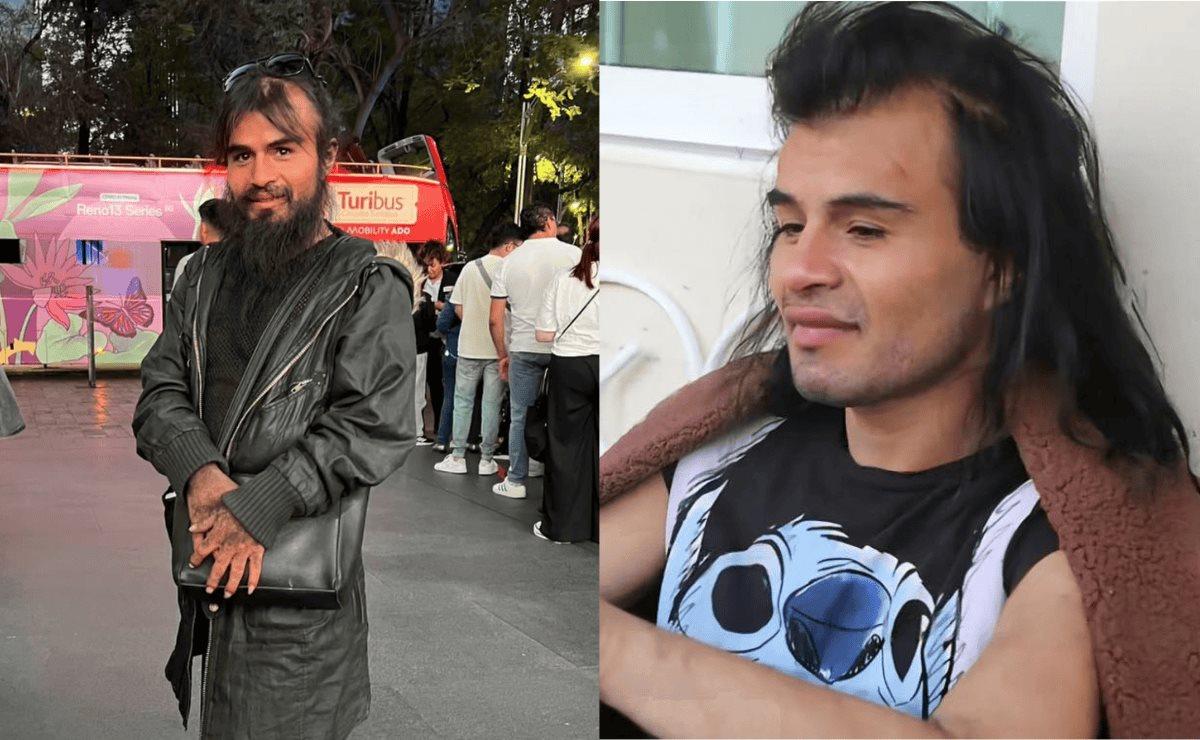 Diva indigente: el impactante cambio tras 25 días de rehabilitación