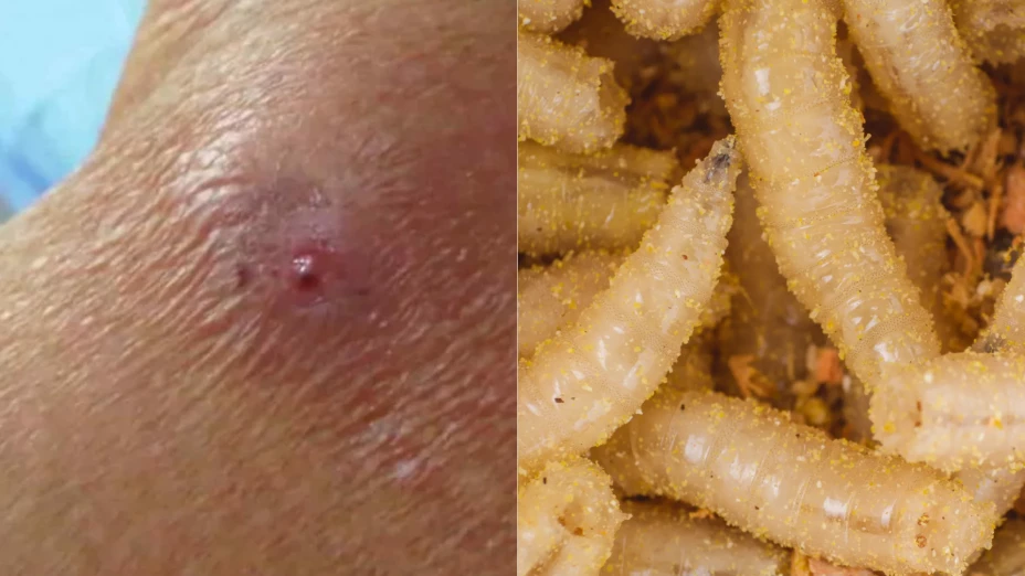 ¡Alerta! Confirman casos de Miasis por gusano barrenador en México