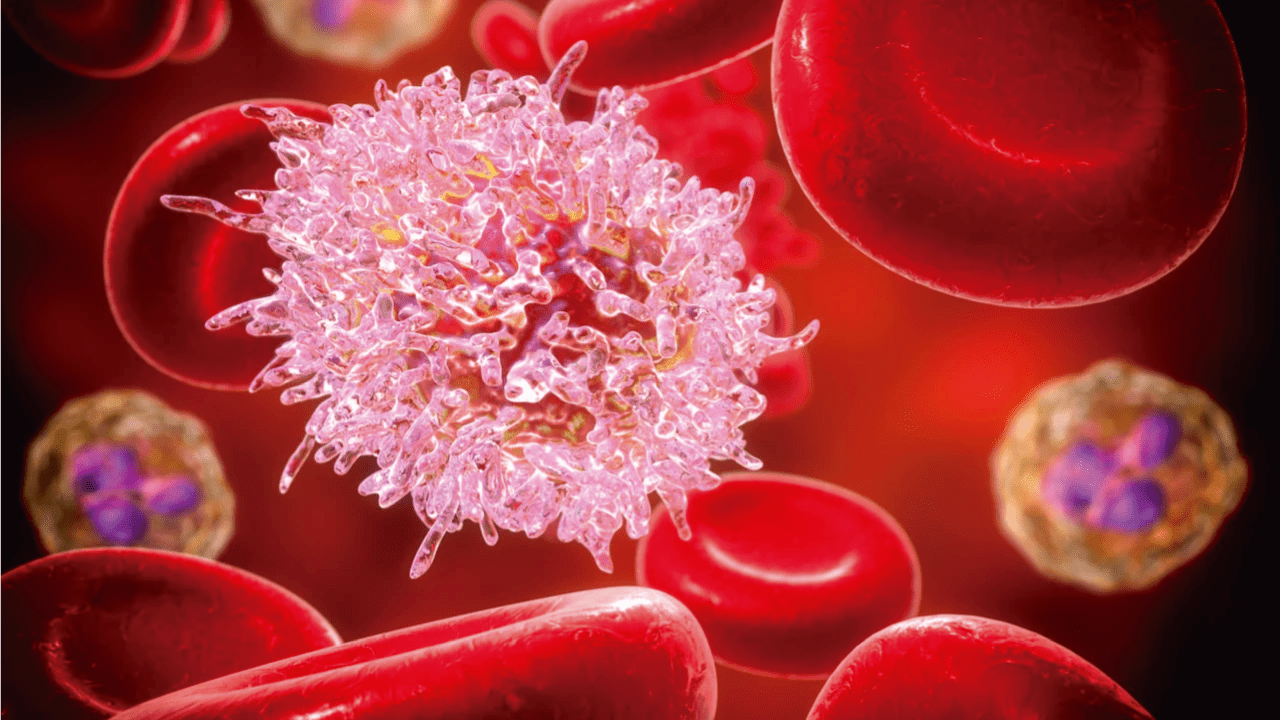 La leucemia mieloide aguda: la nueva prueba que puede salvar tu vida antes de que sea tarde