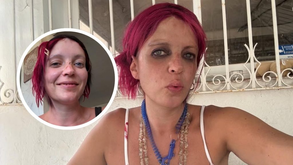 Sheila Devil preocupa: Sus recientes fotos encienden alarmas