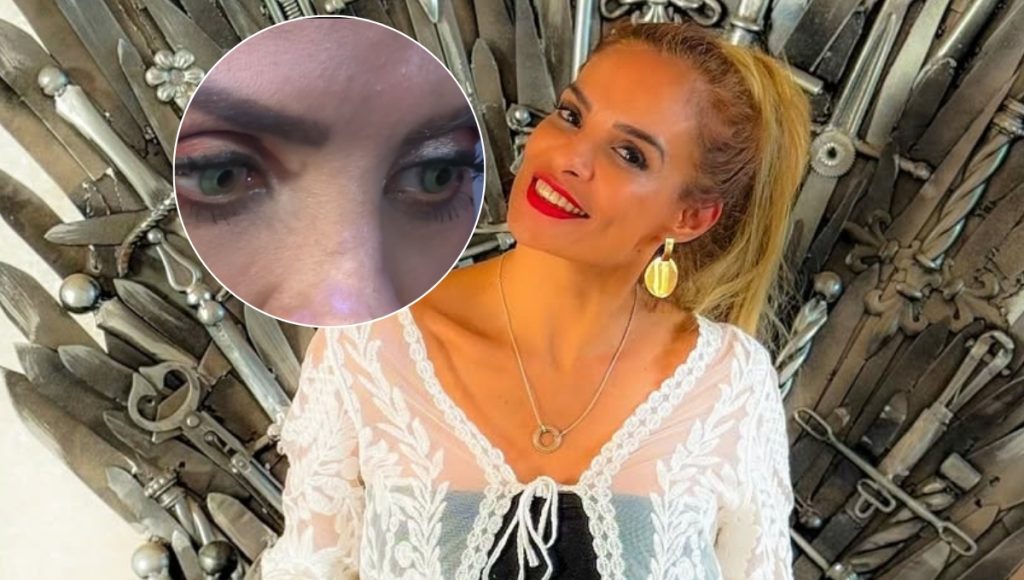 Alma Cero revela detalles de su cirugía estética de cambio de color de ojos