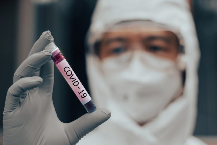 Estudio revela que el Covid-19 envejece los vasos sanguíneos de las mujeres