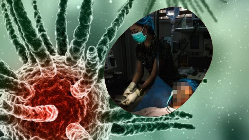 Hallan hongo mortal en cerebro de paciente: la OMS alerta sobre su resistencia