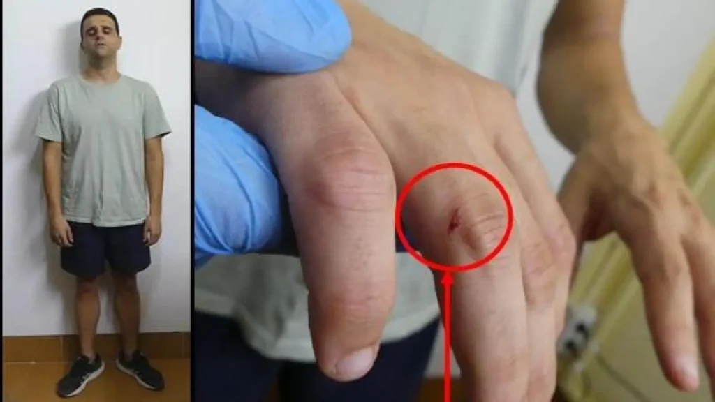 Parricidio en Murcia: hijo asesina a golpes a su padre en su negocio