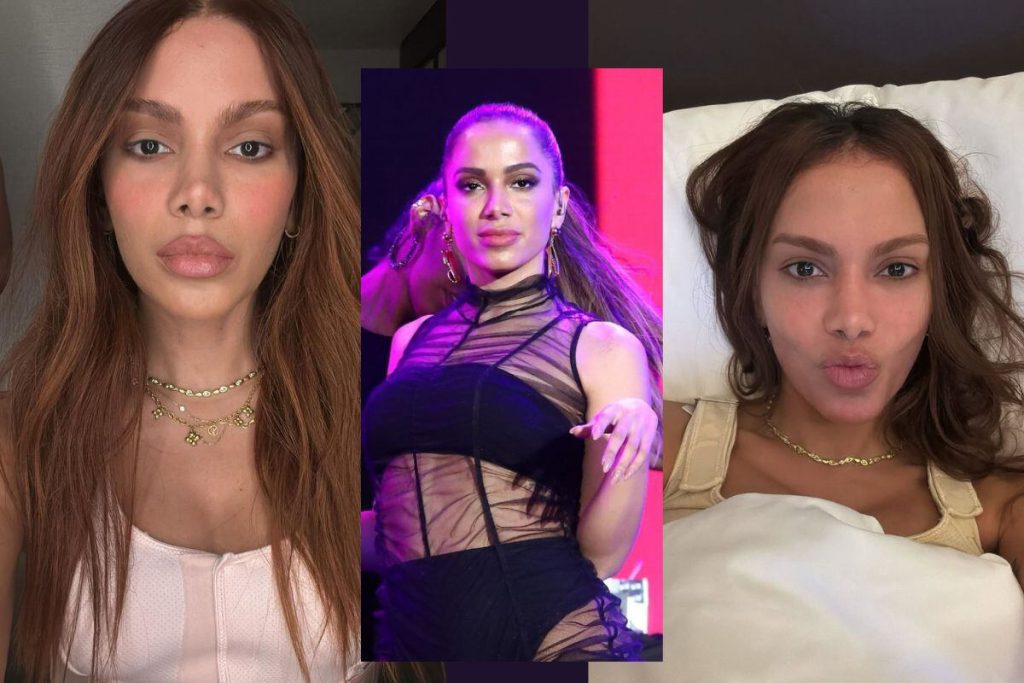 Anitta 'irreconocible': El cambio facial que enciende las redes sociales