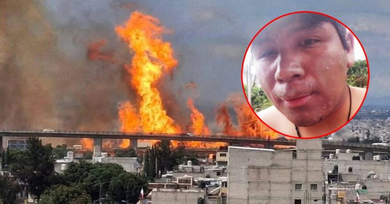 Kevin díaz, el joven quemado en explosión de pipa, muestra recuperación y recibe apoyo médico