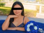 Tragedia en Honduras: Fallece quinceañera tras grave accidente automovilístico