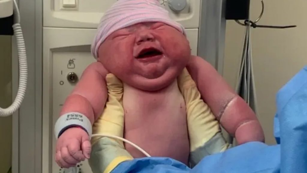 Bebé récord: Madre sorprende al dar a luz a bebé de Ccasi 6 kilos
