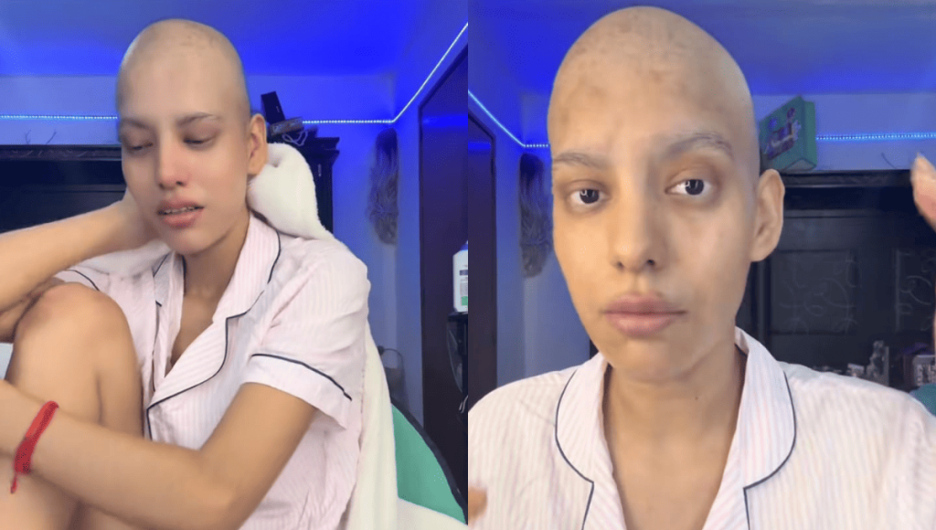 Tiktoker Juliet Zaragoza: Inspiración viral en su lucha contra el cáncer