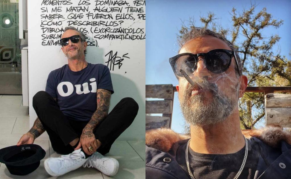 Tito Fuentes de Molotov revela cirugía reconstructiva tras adicciones