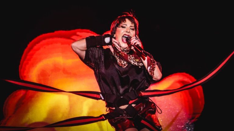 Alejandra Guzmán revela la verdad de su cuerpo: "Abrazo biomecánico"