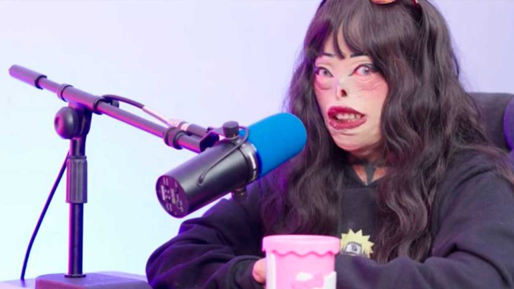 El fuego que cambió la vida de Bjork Hernández: 75% de quemaduras y el refugio en el satanismo