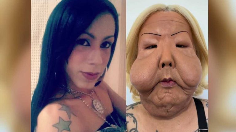 La tragedia de Juju do Pix: cómo una clínica ilegal desfiguró a la influencer