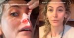 Paris Jackson revela la verdad detrás de su tabique perforado por drogas