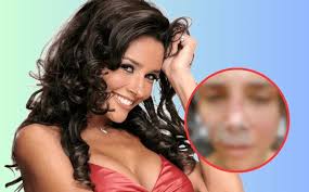 El martirio estético de Dorismar: tres cirugías fallidas y una demanda millonaria