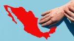 México en alerta máxima por sarampión: 5,580 casos en 29 estados