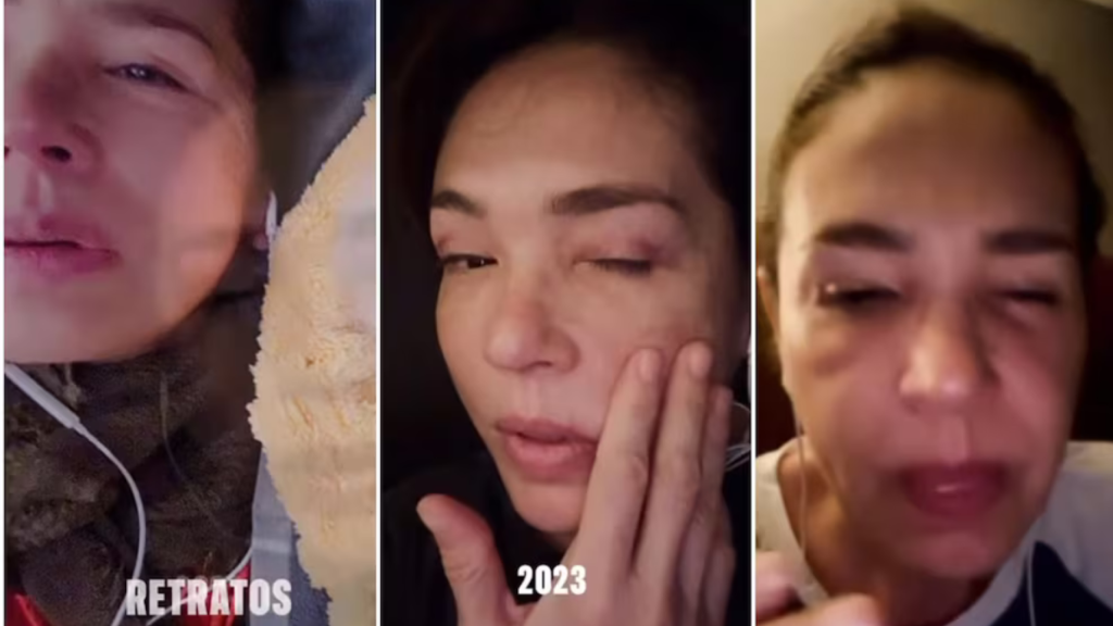 Yolanda Andrade documenta su deterioro físico por ELA desde 2023