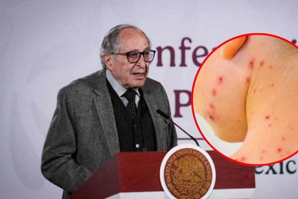 México refuerza vacunación contra sarampión rumbo al Mundial 2026